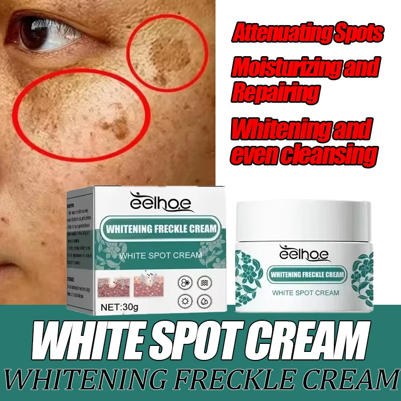 eelhoe Niacinamide Melasma Brightening Cream Reduce Melanin Brighten Cream Lighten Dark Skin Chloasma Serum Fade Fine Face Lines